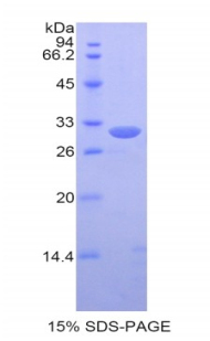 PDIA3 / ERp57 Protein - Recombinant Protein Disulfide Isomerase A3 By SDS-PAGE