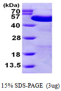 PDIA6 / ERP5 Protein