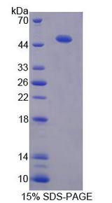 PDIA6 / ERP5 Protein - Recombinant Protein Disulfide Isomerase A6 By SDS-PAGE