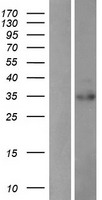 PDIK1L Protein - Western validation with an anti-DDK antibody * L: Control HEK293 lysate R: Over-expression lysate