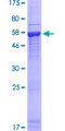 PDIK1L Protein - 12.5% SDS-PAGE of human PDIK1L stained with Coomassie Blue