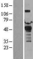 PDK1 Protein - Western validation with an anti-DDK antibody * L: Control HEK293 lysate R: Over-expression lysate