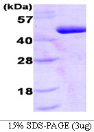 PDK1 Protein