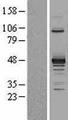 PDK2 Protein - Western validation with an anti-DDK antibody * L: Control HEK293 lysate R: Over-expression lysate