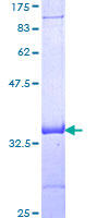 PDK2 Protein - 12.5% SDS-PAGE Stained with Coomassie Blue.