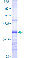 PDK3 Protein - 12.5% SDS-PAGE Stained with Coomassie Blue.