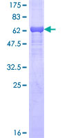PDK4 Protein - 12.5% SDS-PAGE of human PDK4 stained with Coomassie Blue