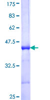 PDK4 Protein - 12.5% SDS-PAGE Stained with Coomassie Blue.