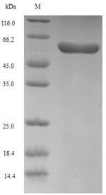 PDLIM1 Protein - (Tris-Glycine gel) Discontinuous SDS-PAGE (reduced) with 5% enrichment gel and 15% separation gel.
