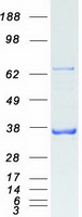 PDLIM1 Protein - Purified recombinant protein PDLIM1 was analyzed by SDS-PAGE gel and Coomassie Blue Staining