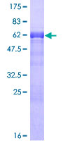 PDLIM2 / SLIM Protein - 12.5% SDS-PAGE of human PDLIM2 stained with Coomassie Blue