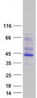 PDLIM2 / SLIM Protein - Purified recombinant protein PDLIM2 was analyzed by SDS-PAGE gel and Coomassie Blue Staining