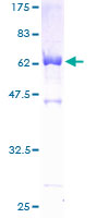 PDLIM3 Protein - 12.5% SDS-PAGE of human PDLIM3 stained with Coomassie Blue