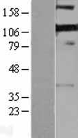 PDLIM4 / RIL Protein - Western validation with an anti-DDK antibody * L: Control HEK293 lysate R: Over-expression lysate