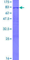 PDLIM7 / Enigma Protein - 12.5% SDS-PAGE of human PDLIM7 stained with Coomassie Blue