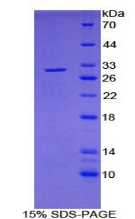 PDP1 Protein - Recombinant Pyruvate Dehydrogenase Phosphatase By SDS-PAGE
