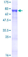 PDP2 Protein - 12.5% SDS-PAGE of human PDP2 stained with Coomassie Blue