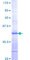 PDPK1 / PDK1 Protein - 12.5% SDS-PAGE Stained with Coomassie Blue.