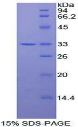 PDPK1 / PDK1 Protein - Recombinant Phosphoinositide Dependent Protein Kinase 1 By SDS-PAGE
