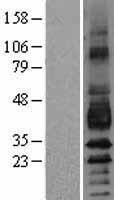 PDPN / Podoplanin Protein - Western validation with an anti-DDK antibody * L: Control HEK293 lysate R: Over-expression lysate