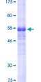 PDPN / Podoplanin Protein - 12.5% SDS-PAGE of human PDPN stained with Coomassie Blue