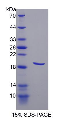 PDPN / Podoplanin Protein - Recombinant  Podoplanin By SDS-PAGE
