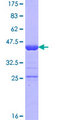 PDRG1 Protein - 12.5% SDS-PAGE of human PDRG1 stained with Coomassie Blue