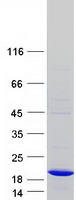 PDRG1 Protein - Purified recombinant protein PDRG1 was analyzed by SDS-PAGE gel and Coomassie Blue Staining