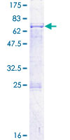 PDS5A Protein - 12.5% SDS-PAGE of human PDS5A stained with Coomassie Blue