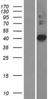 PDSS2 / DLP1 Protein - Western validation with an anti-DDK antibody * L: Control HEK293 lysate R: Over-expression lysate