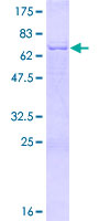PDSS2 / DLP1 Protein - 12.5% SDS-PAGE of human PDSS2 stained with Coomassie Blue