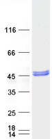 PDSS2 / DLP1 Protein - Purified recombinant protein PDSS2 was analyzed by SDS-PAGE gel and Coomassie Blue Staining