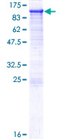 PDXDC1 Protein - 12.5% SDS-PAGE of human PDXDC1 stained with Coomassie Blue
