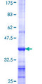 PDXK / PNK Protein - 12.5% SDS-PAGE Stained with Coomassie Blue.