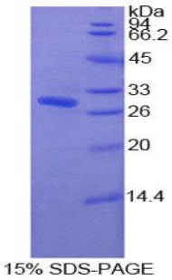 PDXK / PNK Protein - Recombinant Pyridoxal Kinase By SDS-PAGE