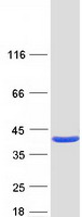 PDXK / PNK Protein - Purified recombinant protein PDXK was analyzed by SDS-PAGE gel and Coomassie Blue Staining