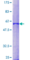 PDYN / ProDynorphin Protein - 12.5% SDS-PAGE of human PDYN stained with Coomassie Blue