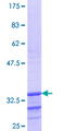 PDYN / ProDynorphin Protein - 12.5% SDS-PAGE Stained with Coomassie Blue.