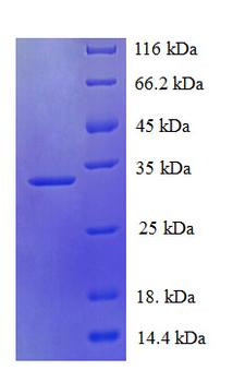 PDZD11 / PISP Protein