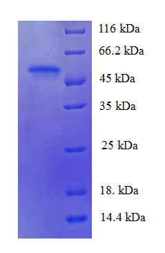 PDZK1 Protein