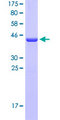 PEA15 / PEA-15 Protein - 12.5% SDS-PAGE of human PEA15 stained with Coomassie Blue