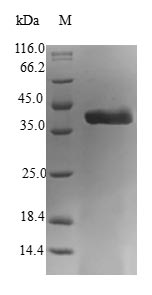 PEA15 / PEA-15 Protein - (Tris-Glycine gel) Discontinuous SDS-PAGE (reduced) with 5% enrichment gel and 15% separation gel.