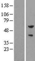 PEA3 / ETV4 Protein - Western validation with an anti-DDK antibody * L: Control HEK293 lysate R: Over-expression lysate
