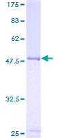 PEA3 / ETV4 Protein - 12.5% SDS-PAGE of human ETV4 stained with Coomassie Blue