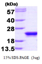PEBP1 / RKIP Protein
