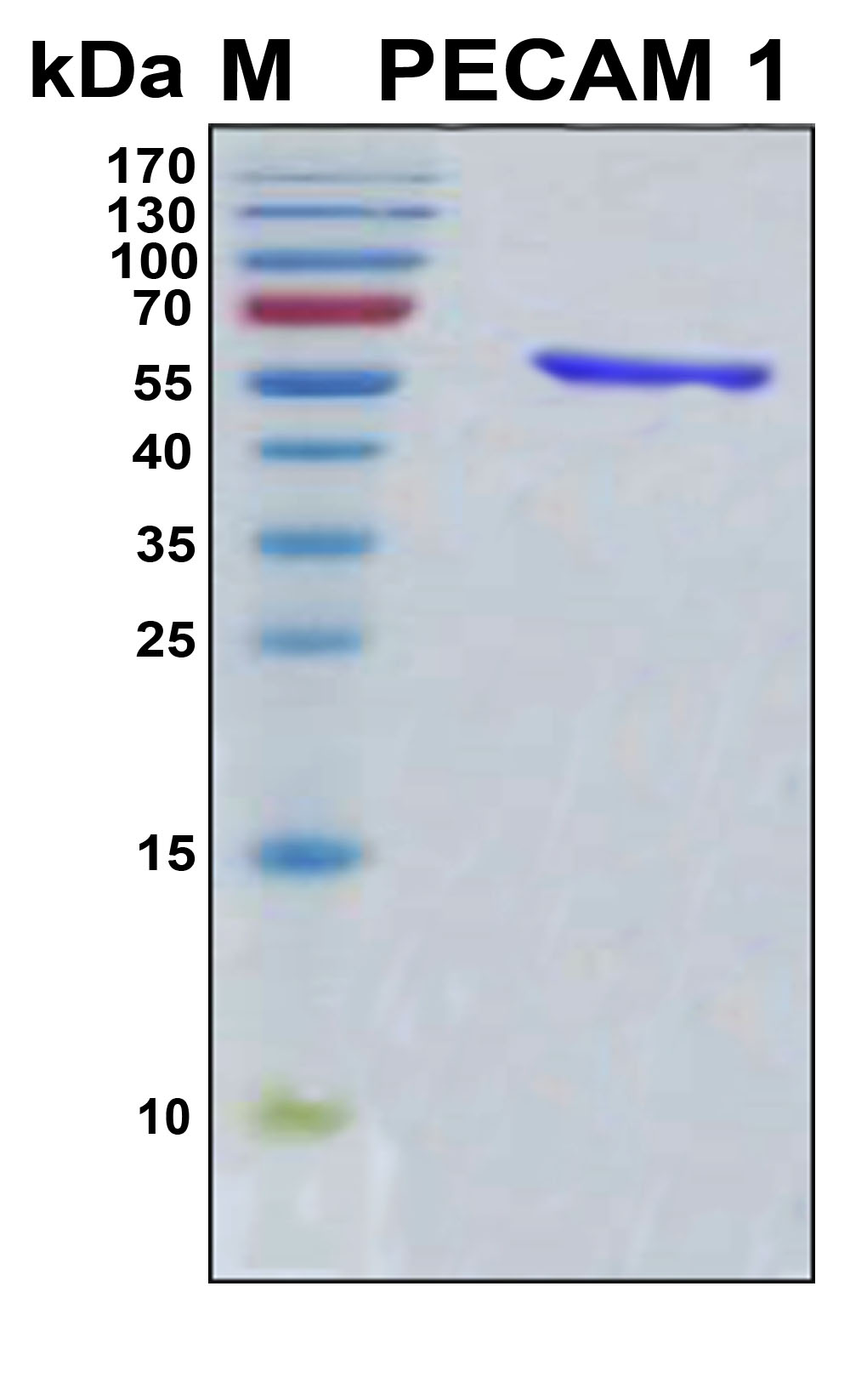 PECAM-1 / CD31 Protein - SDS-PAGE under reducing conditions and visualized by Coomassie blue staining