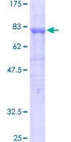 PECAM-1 / CD31 Protein - 12.5% SDS-PAGE of human PECAM1 stained with Coomassie Blue