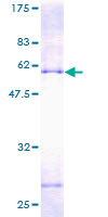 PECR Protein - 12.5% SDS-PAGE of human PECR stained with Coomassie Blue