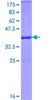 PELI1 / Pellino 1 Protein - 12.5% SDS-PAGE of human PELI1 stained with Coomassie Blue
