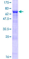 PELO Protein - 12.5% SDS-PAGE of human PELO stained with Coomassie Blue